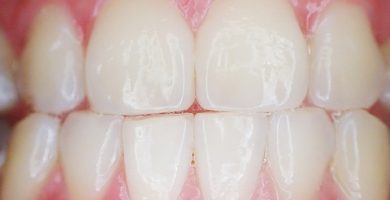 Apps para cuidar tus dientes
